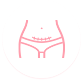 blizna